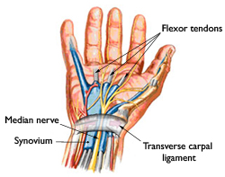 Hand illustrating issues with CTS